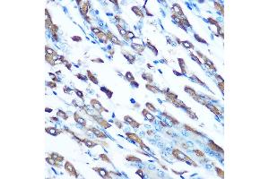 Immunohistochemistry of paraffin-embedded mouse stomach using DMT1 Rabbit pAb (ABIN6129471, ABIN6147839, ABIN6147840 and ABIN6214400) at dilution of 1:100 (40x lens). (SLC11A2 antibody  (AA 1-100))