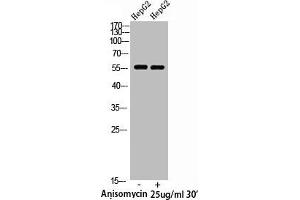 Western Blot analysis of HepG2 cells using Phospho-XIAP (S87) Polyclonal Antibody (XIAP antibody  (pSer87))