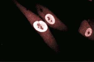 Immunofluorescence staining of human fibroblasts. (GSTP1 antibody  (AA 5-210))
