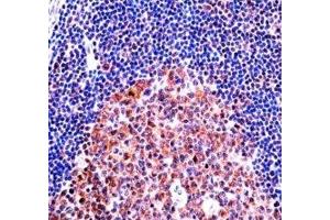 MCM4 antibody immunohistochemistry analysis in formalin fixed and paraffin embedded human tonsil tissue. (MCM4 antibody  (AA 637-665))
