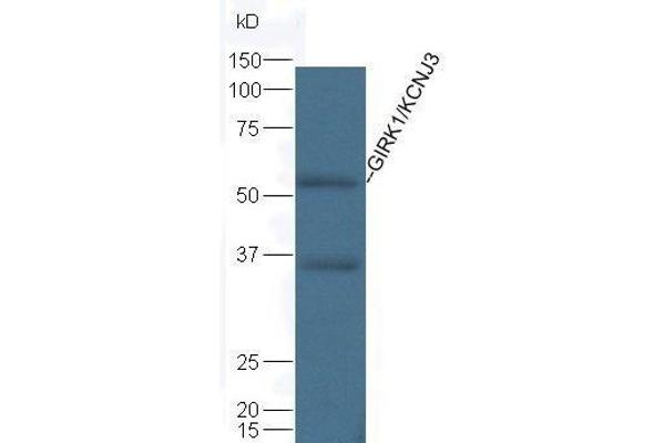 KCNJ3 antibody  (AA 81-180)