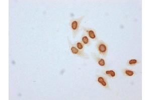 Immunocytochemistry analysis of ABIN7139176 diluted at 1:25 and staining in Hela cells (treated with 30mM sodium butyrate for 4h) performed on a Leica BondTM system. (HIST1H4A antibody  (acLys31))