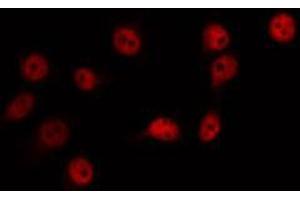 ABIN6266718 staining Hela by IF/ICC. (ZIC1/2/3 antibody)
