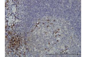 Immunoperoxidase of monoclonal antibody to DCAKD on formalin-fixed paraffin-embedded human tonsil. (DCAKD antibody  (AA 113-200))