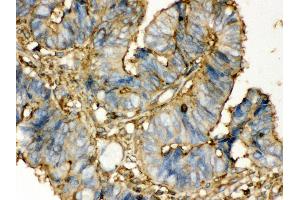 Immunohistochemistry (IHC) image for anti-Transglutaminase 2 (C Polypeptide, Protein-Glutamine-gamma-Glutamyltransferase) (TGM2) (AA 7-34), (N-Term) antibody (ABIN3043946)