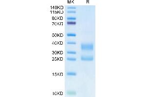 SDS-PAGE (SDS) image for CD3E & CD3G (AA 23-120) protein (His tag,Biotin) (ABIN7274145)