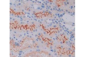 Used in DAB staining on fromalin fixed paraffin- embedded kidney tissue (CAMK1 antibody  (AA 1-370))