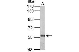 WB Image Sample (50 ug of whole cell lysate) A: Mouse liver 7. (Monoamine Oxidase B antibody)