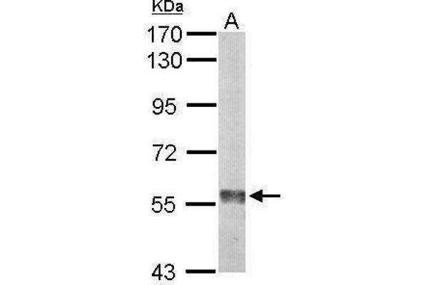 Monoamine Oxidase B antibody