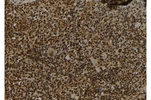 ABIN6273072 at 1/100 staining Mouse spleen tissue by IHC-P. (SECISBP2 antibody  (Internal Region))