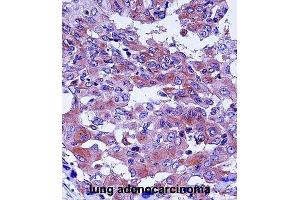 Immunohistochemistry (IHC) image for anti-Complement Decay-Accelerating Factor (CD55) antibody (ABIN2998248)