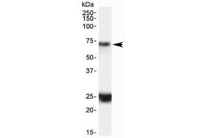 Western blot testing of human hippocampus lysate with HAP1 antibody at 0.