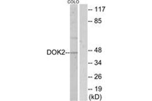 Western Blotting (WB) image for anti-DOK2 (DOK2) (AA 266-315) antibody (ABIN2888973) (DOK2 antibody  (AA 266-315))