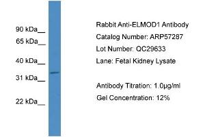 WB Suggested Anti-ELMOD1  Antibody Titration: 0. (ELMOD1 antibody  (Middle Region))