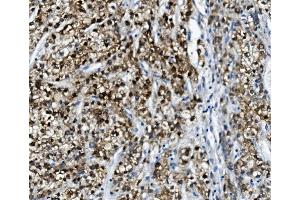IHC analysis of PON1 using anti-PON1 antibody (ABIN7600530). (PON1 antibody  (AA 20-252))