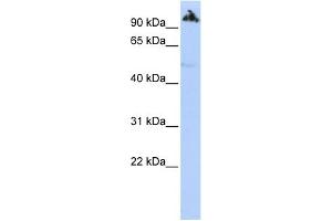 WB Suggested Anti-ZNF845 Antibody Titration:  0.