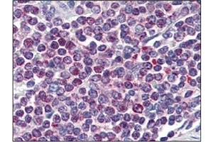 Immunohistochemistry (IHC) image for anti-Nuclear Factor of Activated T-Cells, Cytoplasmic, Calcineurin-Dependent 1 (NFATC1) (AA 428-716) antibody (ABIN336113) (NFATC1 antibody  (AA 428-716))