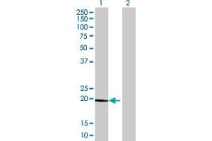 Western Blot analysis of CLEC3B expression in transfected 293T cell line by CLEC3B MaxPab polyclonal antibody.