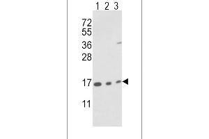Western blot analysis of IA Antibody (N-term) (ABIN389487 and ABIN2839546) in T47D cell line(lane 1) and mouse brain(lane 2),bladder(lane 3) tissue lysates (35 μg/lane). (PPIA antibody  (N-Term))