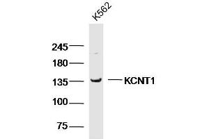 K562 cell lysates probed with KCNT1 Polyclonal Antibody, unconjugated  at 1:300 overnight at 4°C followed by a conjugated secondary antibody for 60 minutes at 37°C. (KCNT1 antibody  (AA 101-200))