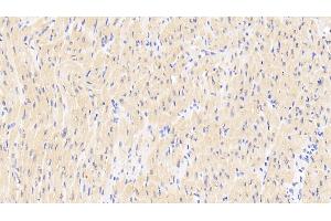 Immunohistochemistry (IHC) image for anti-Tumor Necrosis Factor Receptor Superfamily, Member 11a, NFKB Activator (TNFRSF11A) (AA 330-615) antibody (ABIN7434629)