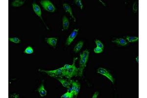 Immunofluorescent analysis of Hela cells using ABIN7164372 at dilution of 1:100 and Alexa Fluor 488-congugated AffiniPure Goat Anti-Rabbit IgG(H+L) (DDX6 antibody  (AA 1-149))