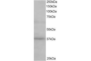 Image no. 1 for anti-ATPase, H+ Transporting, Lysosomal Accessory Protein 2 (ATP6AP2) (C-Term) antibody (ABIN374363) (ATP6AP2 antibody  (C-Term))