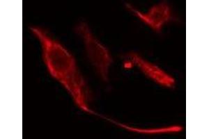 ABIN6275673 staining NIH-3T3 cells by IF/ICC. (VTI1A antibody  (Internal Region))