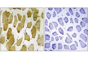 Immunohistochemistry analysis of paraffin-embedded human skeletal muscle, using Arachidonate 5 Lipoxygenase (Phospho-Ser271) Antibody. (ALOX5 antibody  (pSer272))