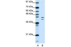 HNRPD antibody used at 1. (HNRNPD/AUF1 antibody)
