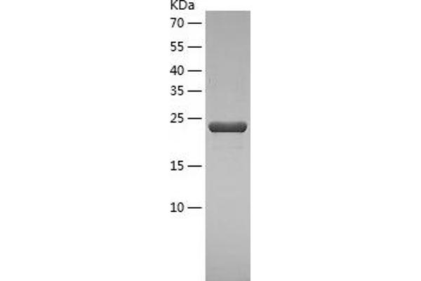 UBE2Z Protein (AA 1-231) (His tag)