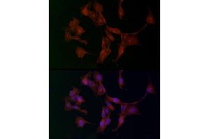Immunofluorescence analysis of U-87 MG cells using  Rabbit pAb (ABIN3016805, ABIN3016806, ABIN3016807 and ABIN6219845) at dilution of 1:100. (ADAMTS5 antibody  (AA 731-930))