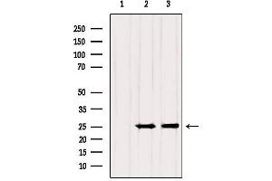 Western blot analysis of extracts from various samples, using RAB3A Antibody.