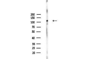 anti-G Protein-Coupled Receptor 113 (GPR113) (N-Term) antibody