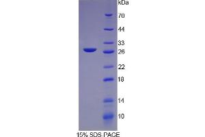 SDS-PAGE of Protein Standard from the Kit (Highly purified E. (CRP CLIA Kit)