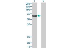 Western Blot analysis of PRKAA2 expression in transfected 293T cell line by PRKAA2 monoclonal antibody (M02), clone 1G8.