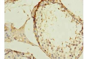 Immunohistochemistry of paraffin-embedded human testis tissue using ABIN7175982 at dilution of 1:100 (ZBTB43 antibody  (AA 165-467))