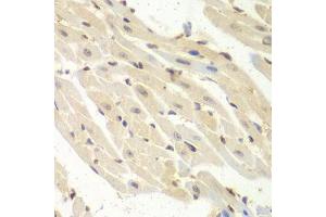 Immunohistochemistry of paraffin-embedded mouse heart using PSME1 antibody. (PSME1 antibody  (AA 1-249))