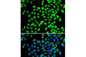 Immunofluorescence analysis of A-549 cells using SGTA Polyclonal Antibody (SGTA antibody)