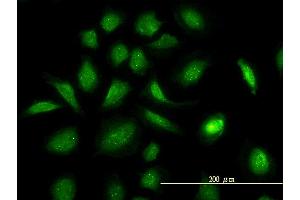 Immunofluorescence of monoclonal antibody to GART on HeLa cell.