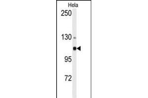 Western blot analysis of anti-ACTN4 Antibody (N-term) (ABIN392218 and ABIN2841914) in Hela cell line lysates (35 μg/lane). (alpha Actinin 4 antibody  (N-Term))
