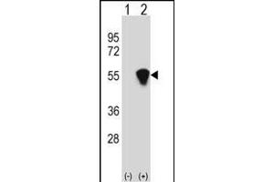 Western blot analysis of RUVBL1 (arrow) using rabbit polyclonal RUVBL1 Antibody (ABIN650670 and ABIN2850421). (RUVBL1 antibody  (AA 247-280))