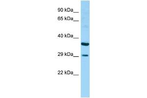 WB Suggested Anti-RAET1G Antibody Titration: 1. (Retinoic Acid Early Transcript 1G (RAET1G) (Middle Region) antibody)