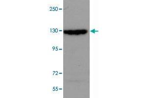 SRGAP2 polyclonal antibody  (0. (SRGAP2 antibody  (Internal Region))