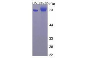 Image no. 2 for Testosterone protein (BSA) (ABIN1880112) (Testosterone Protein (BSA))