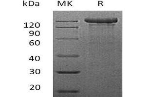 Western Blotting (WB) image for Sema Domain, Immunoglobulin Domain (Ig), Transmembrane Domain (TM) and Short Cytoplasmic Domain, (Semaphorin) 4C (SEMA4C) protein (Fc Tag) (ABIN7320640) (SEMA4C Protein (Fc Tag))