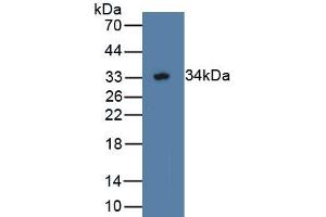 Detection of Recombinant WWP2, Human using Polyclonal Antibody to WW Domain Containing E3 Ubiquitin Protein Ligase 2 (WWP2) (WWP2 antibody  (AA 601-870))