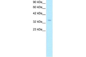 WB Suggested Anti-ZNF391 Antibody Titration:  0. (ZNF391 antibody  (N-Term))