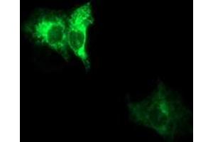 Immunofluorescence (IF) image for anti-ADAM Metallopeptidase with thrombospondin Type 1 Motif, 8 (ADAMTS8) antibody (ABIN1496471) (ADAMTS8 antibody)
