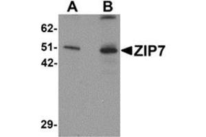 Western blot analysis of ZIP7 in mouse brain tissue lysate with ZIP7 antibody at (A) 0. (SLC39A7 antibody  (N-Term))